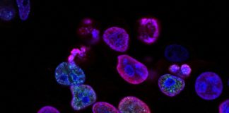 purple cells